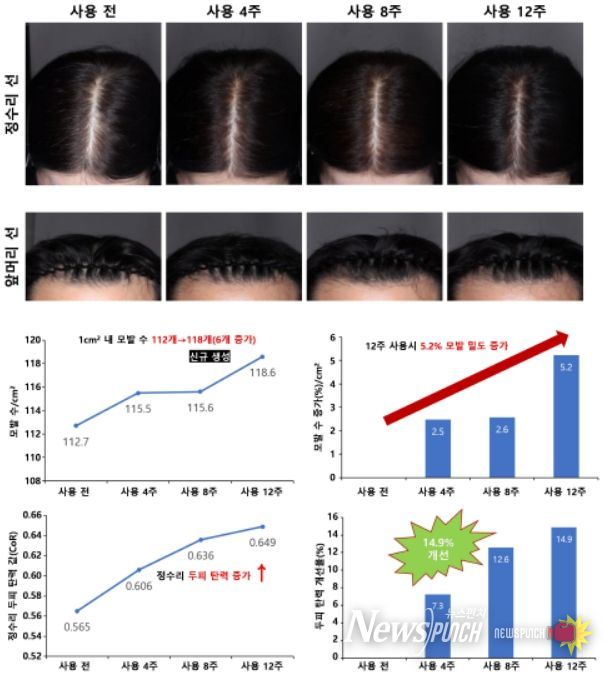 모발 밀도와 두피 탄력 개선